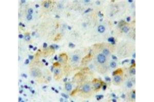 Used in DAB staining on fromalin fixed paraffin-embedded Liver tissue (PVRL2 anticorps  (AA 83-291))