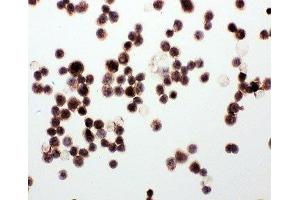 ICC testing of WISP1 antibody and MCF-7 cells