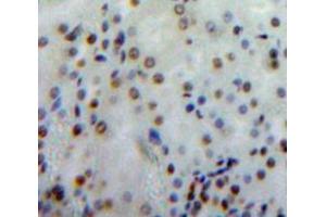 Used in DAB staining on fromalin fixed paraffin-embedded Kidney tissue (Merlin anticorps  (AA 30-239))
