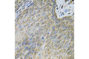 Immunohistochemistry of paraffin-embedded human esophagus using  Antibody (ABIN6127328, ABIN6136696, ABIN6136697 and ABIN6217467) at dilution of 1:100 (40x lens). (Adenylate Kinase 1 anticorps  (AA 1-194))