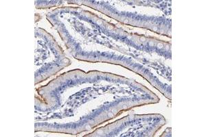 Immunohistochemical staining of human small intestine with SLC44A2 polyclonal antibody  shows membranous positivity in glandular cells. (SLC44A2 anticorps)