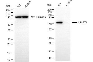 Western blotting analysis using LPCAT1 antibody (ABIN7799305).