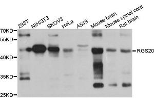 Western blot analysis of extract of various cells, using RGS20 antibody.