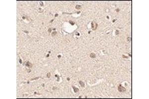 Immunohistochemistry of Slitrk3 in human brain tissue with this product at 2. (SLITRK3 anticorps  (C-Term))