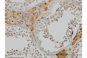 Immunoperoxidase of monoclonal antibody to CREB3 on formalin-fixed paraffin-embedded human testis.