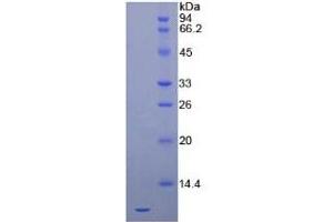 SDS-PAGE of Protein Standard from the Kit  (Highly purified E.