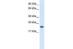 WB Suggested Anti-HMGB3 Antibody Titration:  0. (HMGB3 anticorps  (C-Term))