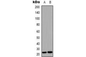 Western blot analysis of FGF9 expression in HEK293T (A), human brain (B) whole cell lysates.