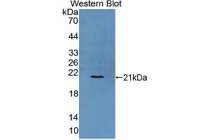 Western Blotting (WB) image for anti-Collagen, Type VI, alpha 3 (COL6a3) (AA 463-624) antibody (ABIN1867320) (COL6a3 anticorps  (AA 463-624))