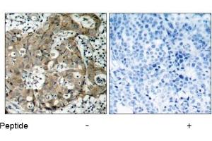 Image no. 2 for anti-Forkhead Box O1 (FOXO1) (Ser319) antibody (ABIN197367) (FOXO1 anticorps  (Ser319))