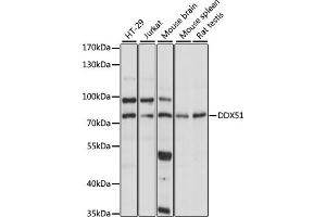 Western blot analysis of extracts of various cell lines, using DDX51 antibody (ABIN7266699) at 1:1000 dilution. (DDX51 anticorps  (AA 367-666))