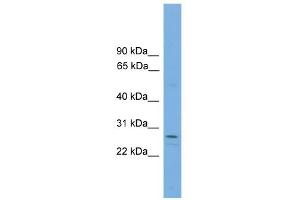 WB Suggested Anti-RCAN1 Antibody Titration: 0. (RCAN1 anticorps  (N-Term))