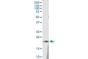 Immunoprecipitation of TSEN15 transfected lysate using anti-TSEN15 MaxPab rabbit polyclonal antibody and Protein A Magnetic Bead , and immunoblotted with TSEN15 MaxPab mouse polyclonal antibody (B01) .