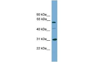WB Suggested Anti-RAD1  Antibody Titration: 0. (RAD1 anticorps  (Middle Region))