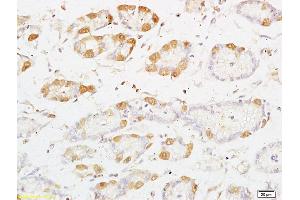 Formalin-fixed and paraffin embedded rat kidney tissue labeled with Anti-PRKD3 Polyclonal Antibody, Unconjugated (ABIN754678) at 1:200 followed by conjugation to the secondary antibody and DAB staining (PRKD3 anticorps  (AA 345-550))