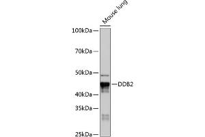 Western blot analysis of extracts of Mouse lung, using DDB2 Rabbit mAb (ABIN7266674) at 1:1000 dilution. (DDB2 anticorps)