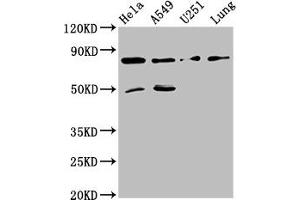 Western Blot Positive WB detected in: Hela whole cell lysate, A549 whole cell lysate, U251 whole cell lysate, Mouse lung tissue All lanes: Pcsk1 antibody at 8 μg/mL Secondary Goat polyclonal to rabbit IgG at 1/50000 dilution Predicted band size: 85 kDa Observed band size: 85 kDa (PCSK2 anticorps  (AA 267-391))