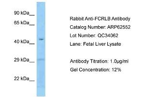 Western Blotting (WB) image for anti-Fc Receptor-Like B (FCRLB) (N-Term) antibody (ABIN2789176) (FCRLB anticorps  (N-Term))