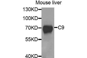 Western blot analysis of extracts of mouse liver, using C9 antibody. (C9 anticorps)