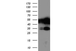 Western Blotting (WB) image for anti-T-Cell Acute Lymphocytic Leukemia 1 (TAL1) antibody (ABIN1501290) (TAL1 anticorps)