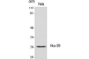 Western Blot analysis of various cells using Hox-B9 Polyclonal Antibody diluted at 1:1000. (HOXB9 anticorps  (AA 180-260))