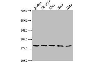 Western Blot Positive WB detected in: Jurkat whole cell lysate, SH-SY5Y whole cell lysate, K562 whole cell lysate, HL-60 whole cell lysate, A549 whole cell lysate All lanes: RPL24 antibody at 1:2000 Secondary Goat polyclonal to rabbit IgG at 1/50000 dilution Predicted band size: 18 kDa Observed band size: 18 kDa (RPL24 anticorps  (AA 1-157))