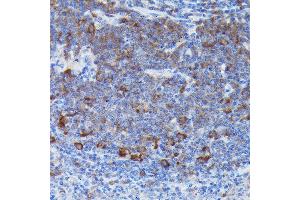 Immunohistochemistry of paraffin-embedded mouse spleen using SOCS3 Rabbit pAb (ABIN3021099, ABIN3021100, ABIN3021101 and ABIN6213950) at dilution of 1:50 (40x lens).