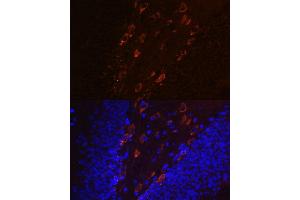 Immunofluorescence analysis of mouse brain using Phospho-Tau-T231 antibody (ABIN7268531).