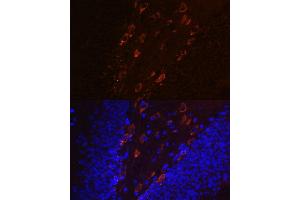 Immunofluorescence analysis of mouse brain using Phospho-Tau-T231 antibody (ABIN7268531). (MAPT anticorps  (pThr231))