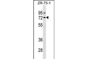 SELE Antibody (Ascites) ABIN1539992 western blot analysis in ZR-75-1 cell line lysates (35 μg/lane). (Selectin E/CD62e anticorps)