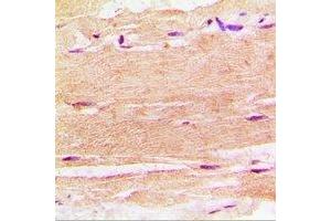 Immunohistochemistry (IHC) image for anti-Sphingosine Kinase 1 (SPHK1) antibody (ABIN7308364)