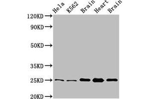 Western Blot Positive WB detected in: Hela whole cell lysate, K562 whole cell lysate, Rat brain tissue, Rat heart tissue, Mouse brain tissu All lanes: SOD2 antibody at 3. (SOD2 anticorps  (AA 64-175))