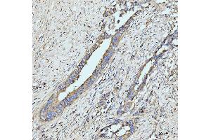 IHC analysis of GRPEL1 using anti-GRPEL1 antibody (ABIN7602643). (GRPEL1 anticorps  (AA 90-217))