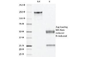 SDS-PAGE Analysis Purified PR Monoclonal Antibody (PR501). (Progesterone Receptor anticorps)