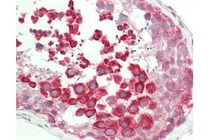 Human Testis: Formalin-Fixed, Paraffin-Embedded (FFPE). (TEX264 anticorps  (AA 143-192))