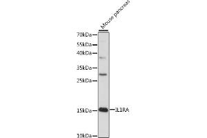 Western blot analysis of extracts of mouse pancreas, using IL1RA antibody (ABIN7267972) at 1:1000 dilution.