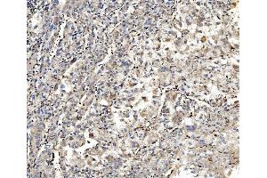 IHC analysis of Aldolase/ALDOA using anti-Aldolase/ALDOA antibody (ABIN7601908). (ALDOA anticorps  (AA 50-364))