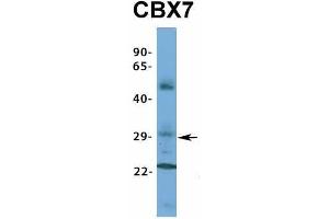 Host:  Rabbit  Target Name:  CBX7  Sample Type:  Human Fetal Muscle  Antibody Dilution:  1. (CBX7 anticorps  (Middle Region))