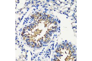 Immunohistochemistry of paraffin-embedded mouse lung using FKBP12 antibody (ABIN3022503, ABIN3022504, ABIN3022505 and ABIN6218864) at dilution of 1:200 (40x lens). (FKBP1A anticorps  (AA 1-108))