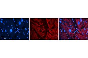 Rabbit Anti-ZYX Antibody    Formalin Fixed Paraffin Embedded Tissue: Human Adult heart  Observed Staining: Cytoplasmic (cytoskeleton) Primary Antibody Concentration: 1:600 Secondary Antibody: Donkey anti-Rabbit-Cy2/3 Secondary Antibody Concentration: 1:200 Magnification: 20X Exposure Time: 0. (ZYX anticorps  (Middle Region))