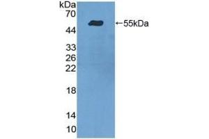 Detection of Recombinant ITGa9, Human using Polyclonal Antibody to Integrin Alpha 9 (ITGa9) (ITGA9 anticorps  (AA 741-965))