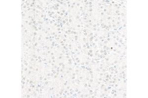 Immunohistochemistry (IHC) image for anti-Replication Protein A2, 32kDa (RPA2) (C-Term) antibody (ABIN7454599) (RPA2 anticorps  (C-Term))