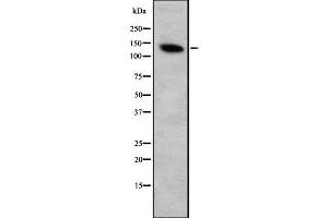 Western blot analysis FOG2 using Jurkat whole cell lysates (ZFPM2 anticorps  (C-Term))
