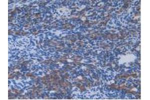 IHC-P analysis of Mouse Ovary Tissue, with DAB staining. (IL13RA2 anticorps  (AA 228-338))