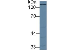Detection of PC in Porcine Cerebrum lysate using Polyclonal Antibody to Pyruvate Carboxylase (PC)