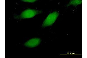 Immunofluorescence of monoclonal antibody to HMGA1 on HeLa cell.