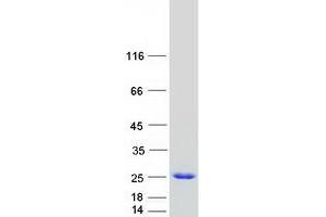 Validation with Western Blot