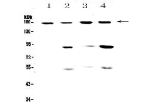 Western blot analysis of CD11b using anti-CD11b antibody . (CD11b anticorps  (AA 129-336))