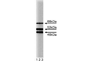 Western blot analysis of SHC on a HeLa cell lysate (Human cervical epitheloid carcinoma, ATCC CCL-2.