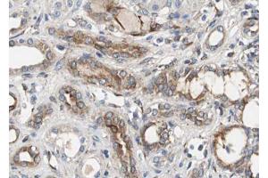 ABIN6267492 at 1/100 staining human Kidney tissue sections by IHC-P. (VEGFR2/CD309 anticorps  (pTyr951))